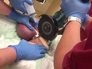 어떻게 NOT A 수탉 반지를 제거하는 방법!
