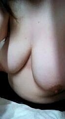 40F Seins Affaissés